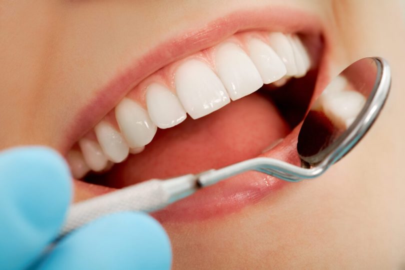 Motivos para ter um Plano Odontológico